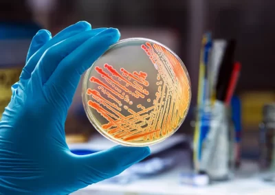 Careers at Cultivator Phyto Lab - Join Our Expert Team 6 colonies bacteria gram negative bacilli gram negative cocco bacilli 1