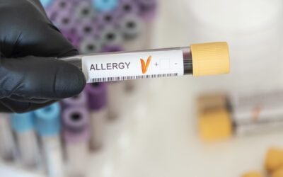 Allergen Testing