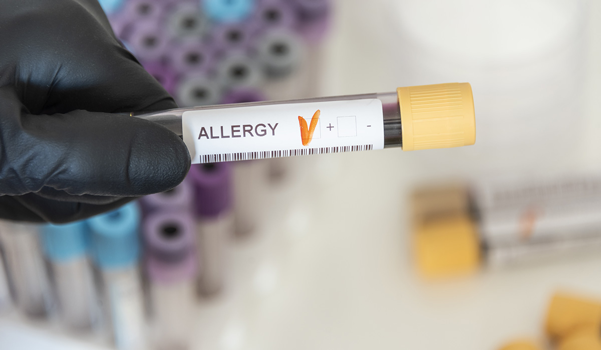 closeup positive blood sample from allergy