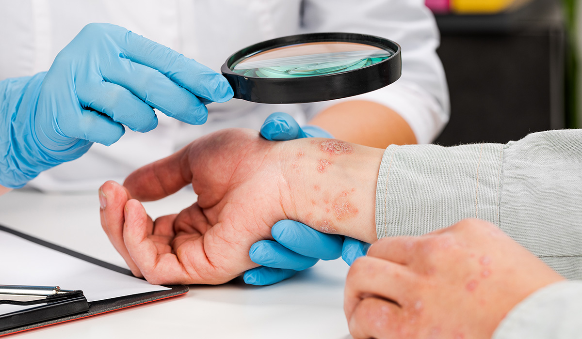 dermatologist wearing gloves examines skin sick patient examination diagnosis skin diseasesallergies psoriasis eczema dermatitis